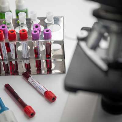 Analysis of the laboratory diagnostic services market in India