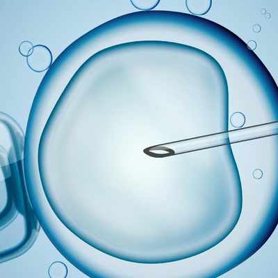 Forecast for the development of the IVF services market in India